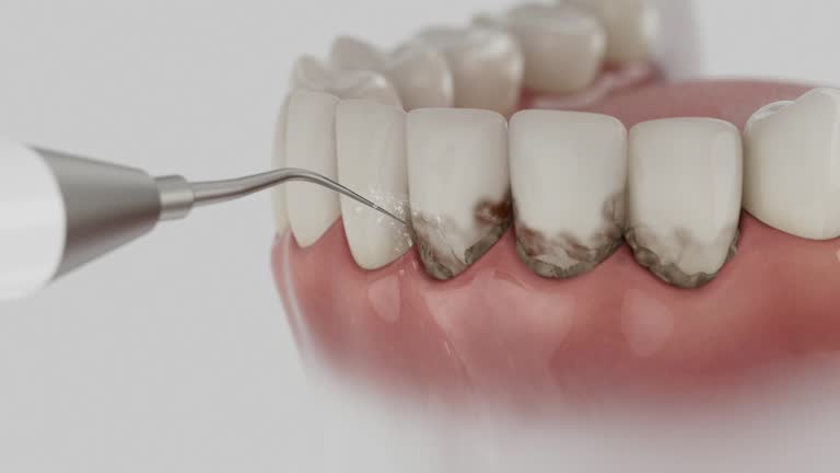 Trusted Dental Crowns And Bridges service in Eagleton Village, TN - Dentist Open Now